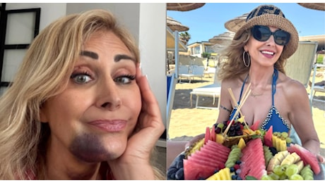 Marina Di Guardo, incidente in Sicilia per la madre di Chiara Ferragni: l'ematoma e il racconto dell'impatto con il trattore