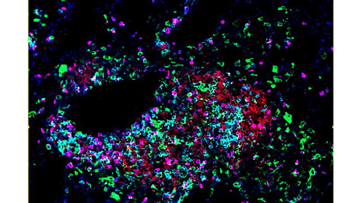 Identificate le cellule che costruiscono avamposti anticancro - Alto Adige