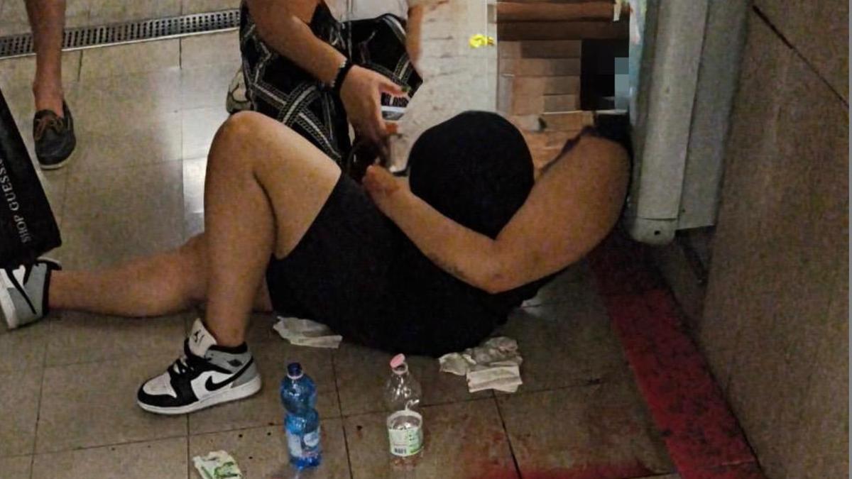 Milano, la ragazza di 22 anni sfregiata in metropolitana: “Gli insulti, gli sputi e la coltellata. Non vedevo, ho pensato di morire”