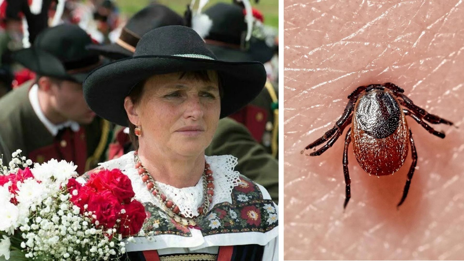 Il morso sui prati vicino a casa, il peggioramento graduale, poi venti giorni d’agonia al Santa Chiara: Gianna Sommavilla è morta dopo un mese per colpa di una zecca