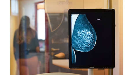 Il capezzolo “intelligente”: Orsini in cattedra per le pazienti oncologiche