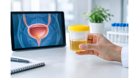 Tumore alla vescica, il test dell’RNA nelle urine apre una nuova strada
