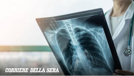 Noduli del polmone, quando asportarli e come si analizzano