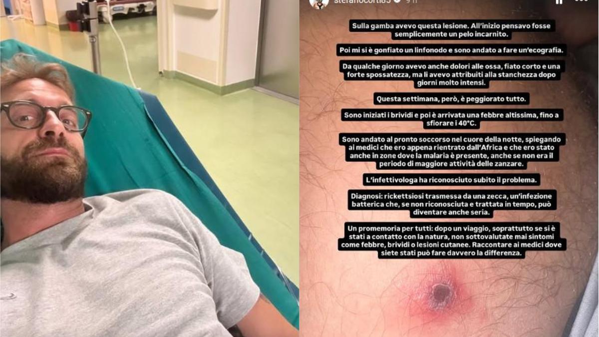 Stefano Corti: “Io in ospedale per rickettsiosi trasmessa da una zecca africana. Febbre quasi a 40 gradi, nausea e dolori. Non sottovalutate i sintomi”